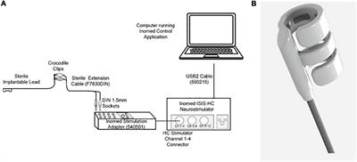 Splenic arterial neurovascular bundle stimulation in esophagectomy: A feasibility and safety prospective cohort study